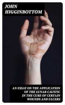 an essay on the application of the lunar caustic in the cure of certain wounds and ulcers (ebook)-john higginbottom-8596547333609