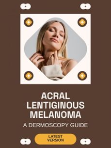 acral lentiginous melanoma (ebook)-harper r. o'malley-9781776837809