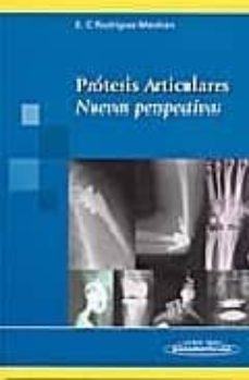protesis articulares: nuevas perspectivas-9788479034009