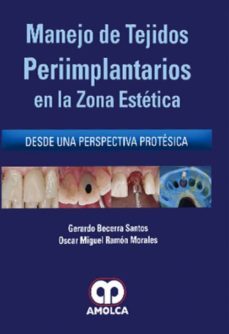 manejo de tejidos periimplantarios en la zona estetica desde una perspectiva protesica-9789585426009