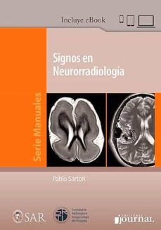 signos en neurorradiologia (incluye e-book)-9789874922809