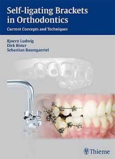 self-ligating brackets in orthodontics: current concepts and tech niques-bjoern ludwig-dirk bister-9783131547019