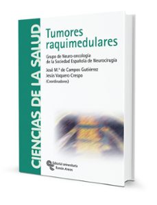 tumores raquimedulares-9788480048019