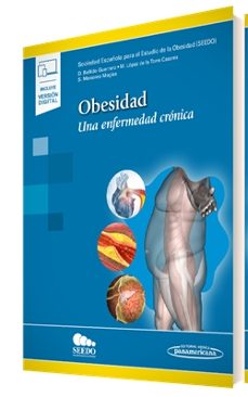 obesidad (incluye version digital)-diego bellido guerrero-manuel lopez de la torre casares-susana monereo megias-9788491107019