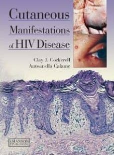 cutaneous manifestations of hiv disease-clay j. cockerell-antoanella calame-9781840761429
