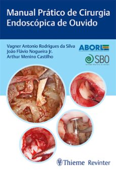 manual pratico de cirurgia endoscopica de ouvido (ebook)-vagner antonio rodrigues da silva-joão flávio nogueira jr.-arthur menino castilho-9786555722529