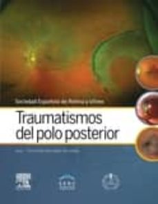 traumatismos del polo posterior-9788491130529