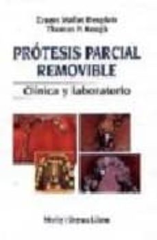 protesis parcial removible: clinica y laboratorio-ernest mallat desplats-9788481740639