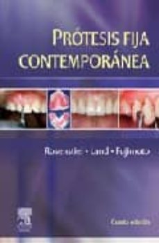 protesis fija contemporanea (4ª ed.)-9788480863049