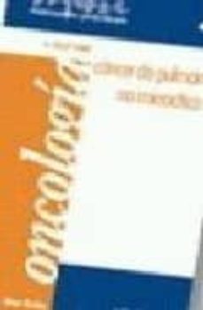 cancer de pulmon no microcitico-felip e. font-9788495913449