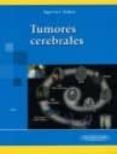 tumores cerebrales-lucinda aguirre cruz-julio sotelo-9789687988849