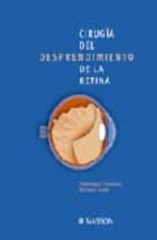 cirugia del desprendimiento de la retina-d. chavaud-f. azan-9788445814659