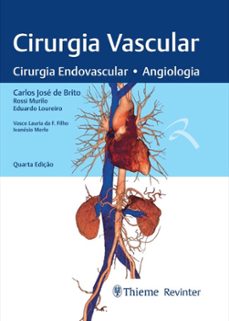 cirurgia vascular (ebook)-carlos josé de brito-rossi murilo da silva-eduardo loureiro de araújo-9788554652159