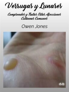 verrugas y lunares (ebook)-owen jones-9788835451259