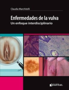 enfermedades de la vulva-claudia marchitelli-9789873954559