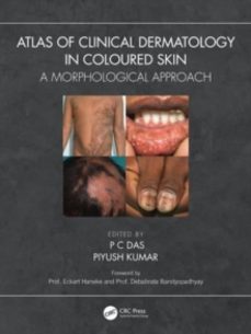 atlas of clinical dermatology in coloured skin-p c das-9781032399669