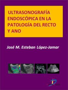 ultrasonografia endoscopica en la patologia del recto y ano (ebook)-jose m. esteban lopez jamar-9788499697369