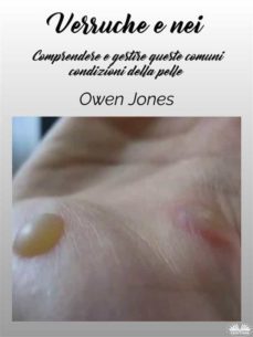 verruche e nei (ebook)-owen jones-9788835448969