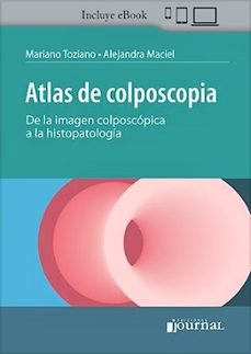 atlas de colposcopia. de la imagen colposcopica a la histopatologia-mariano toziano-alejandra maciel-9789878452869