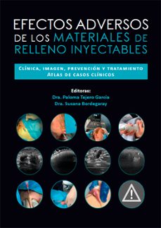 efectos adversos de los materiales de relleno inyectables (ebook)-9788410196179
