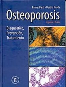 osteoporosis: diagnostico,prevencion tratamiento-reiner bartl-9788478855179
