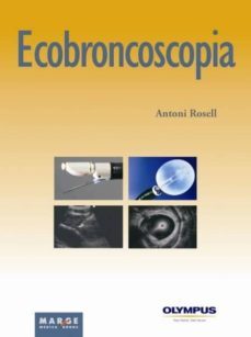 ecobroncoscopia (ebook)-9788415004189