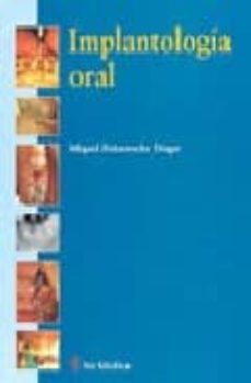 implantologia oral-miguel peñarrocha diago-9788497511889