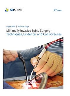 Minimally Invasive Spine Surgery