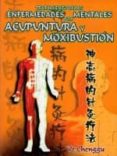 tratamiento de las enfermedades mentales por acupuntura y moxibus tion-ye chenggu-9789685566179 tratamiento de las enfermedades mentales por acupuntura y moxibus tion-ye chenggu-9789685566179