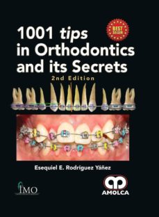 Descarga gratuita de fuentes de libros de texto 1001 TIPS IN ORTHODONTICS AND ITS SECRETS