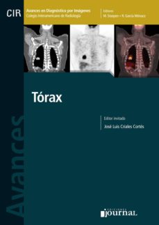 Interpretacion De Radiografia De Torax Epub Download