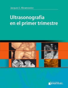 Descargar libros de Kindle it ULTRASONOGRAFIA EN EL PRIMER TRIMESTRE CHM MOBI (Spanish Edition) de JACQUES S. ABRAMOWICZ 9789874922069