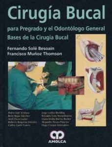 Audiolibros en inglés para descargar gratis CIRUGIA BUCAL PARA PREGRADO Y EL ODONTOGO GENERAL: BASES DE LA CI RUGIA (Spanish Edition)