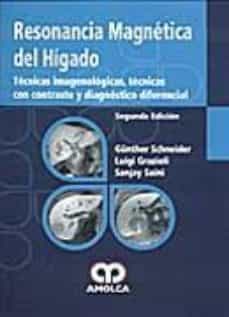 Descargar audiolibros gratis en italiano RESONANCIA MAGNETICA DEL HIGADO (2ª ED) de GÜNTER SCHNEIDER CHM